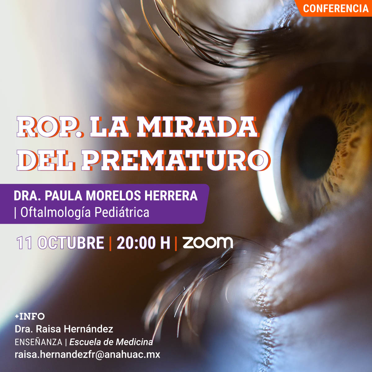 ROP. La Mirada del Prematuro ROP. La Mirada del Prematuro